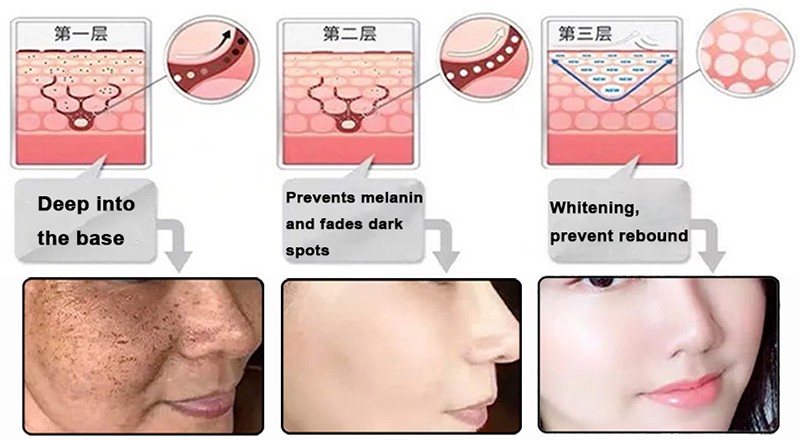 polyglutamic acid Whitening polyglutamic acid Whitening